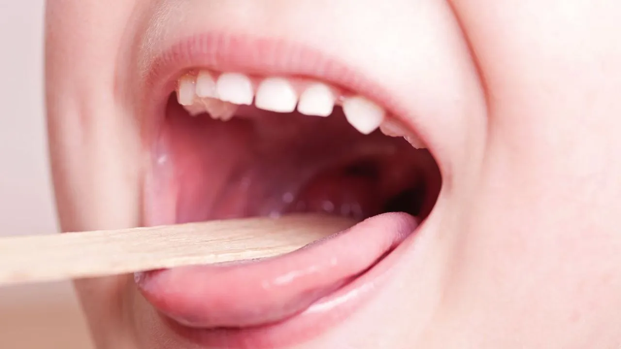 tonsil problem