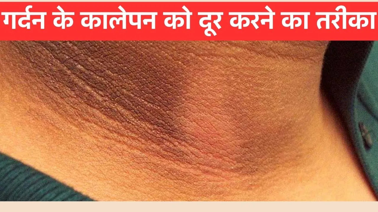 Dark Neck Remedies