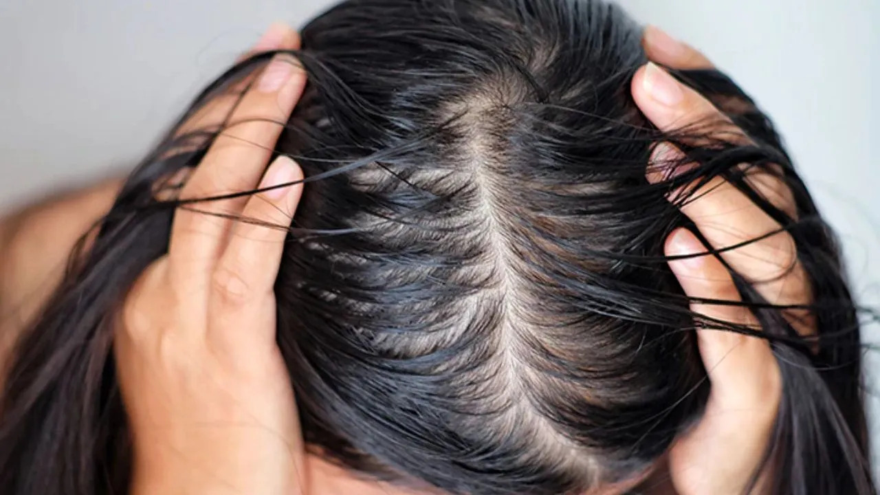 oily hair problem
