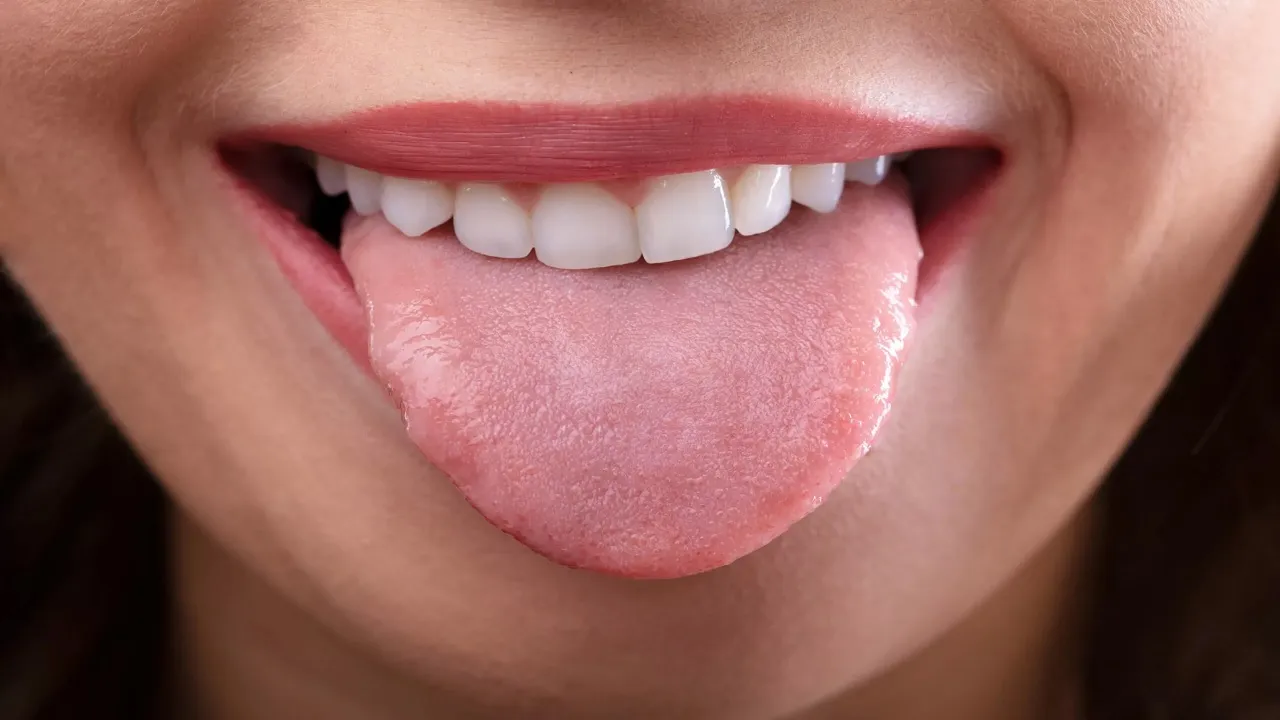 Tongue