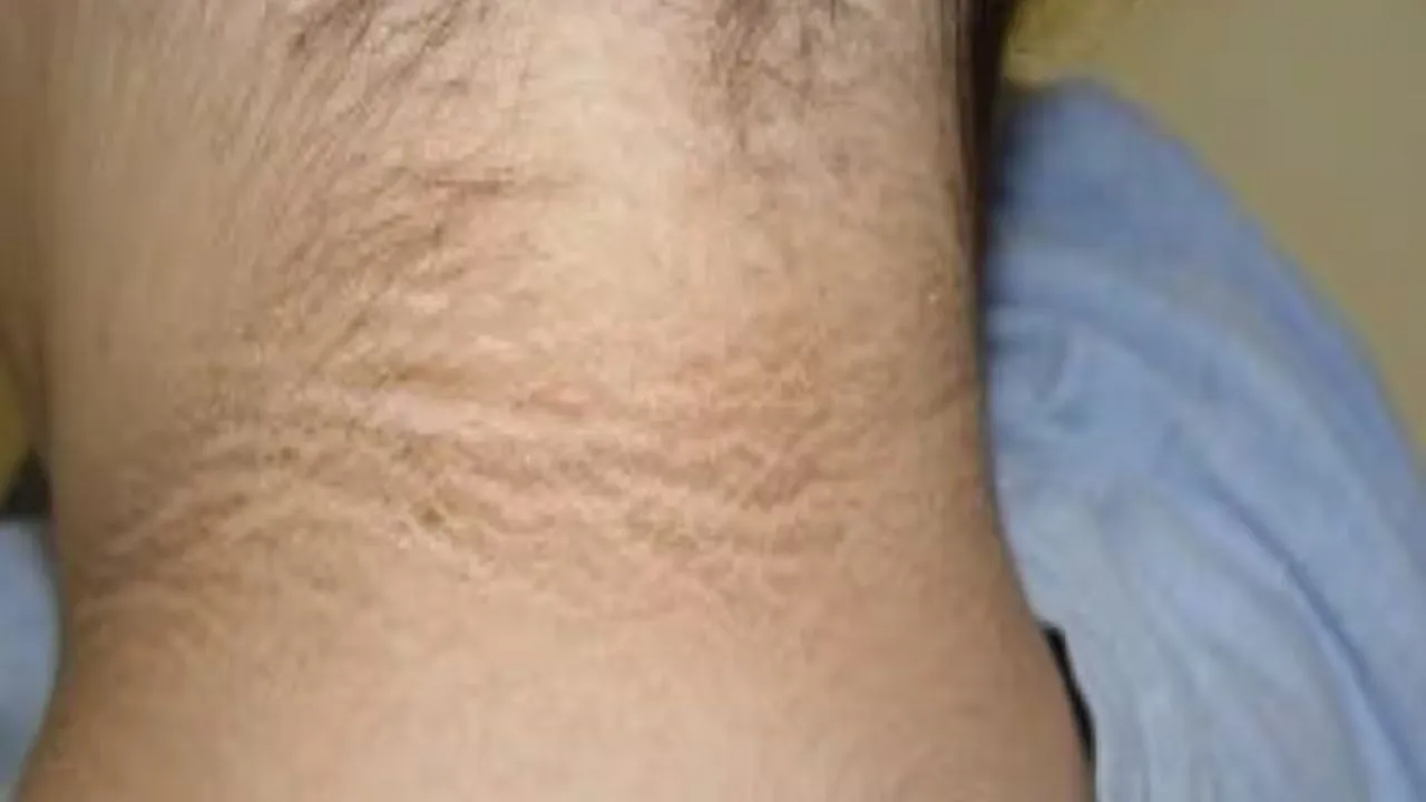 dark neck