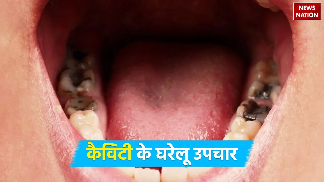 cavity ke gharelu upay using coconut oil
