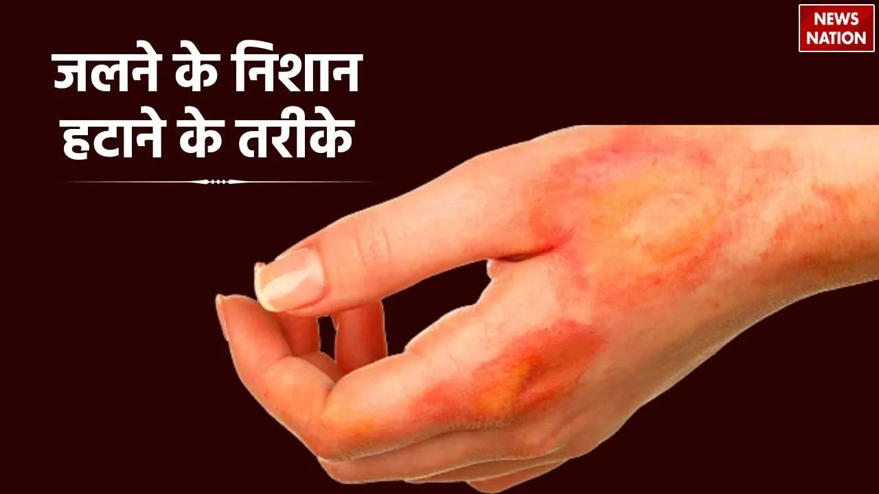 Burn Marks Removel Tips