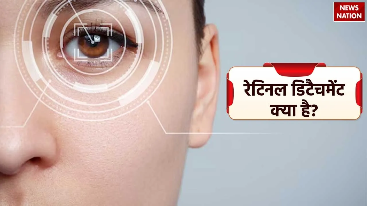 Retinal Detachment