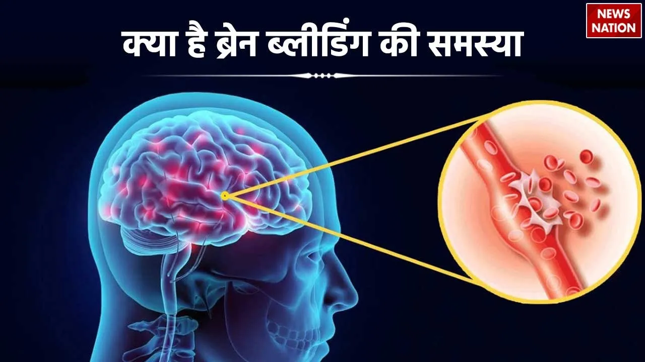 what is brain bleeding