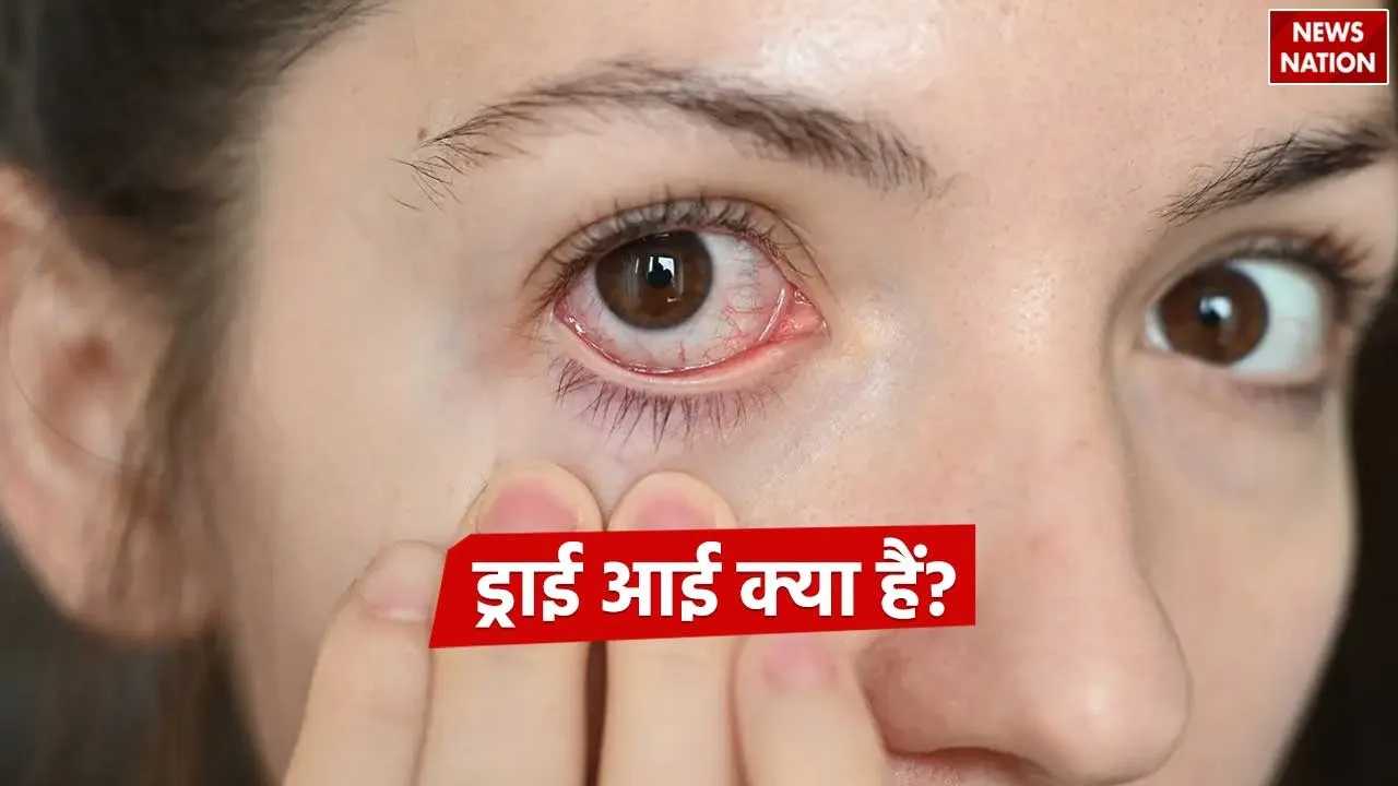 Dry Eyes