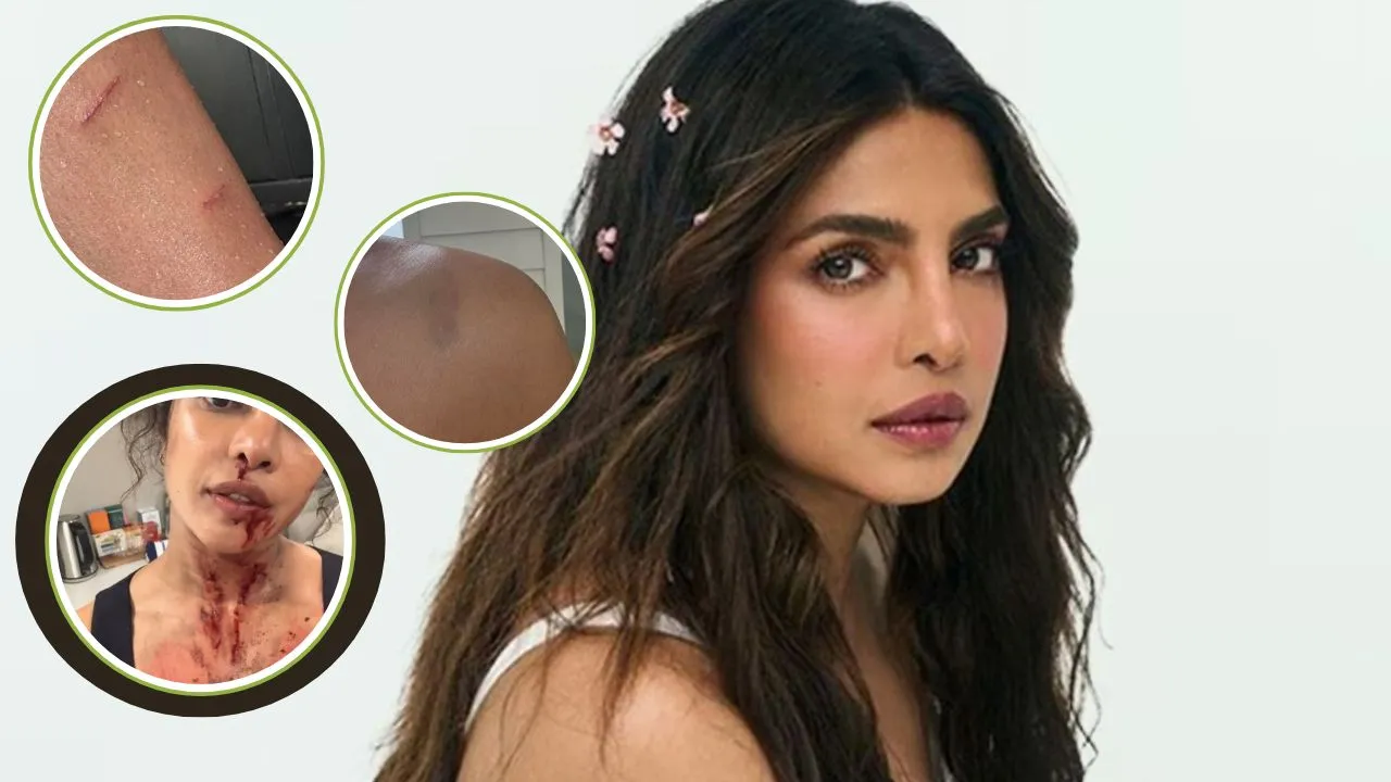 Priyanka Chopra covered in blood