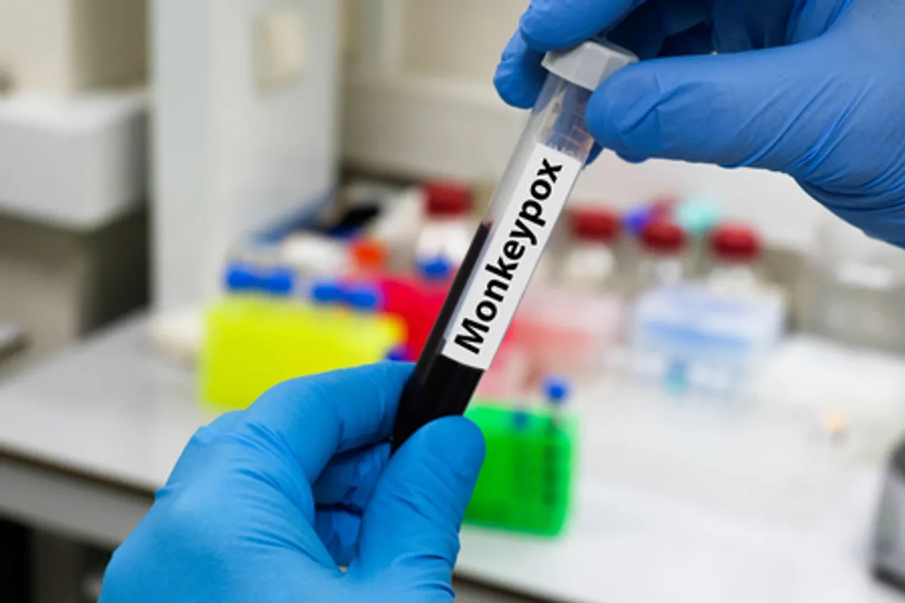 Malawi confirms sixth mpox case