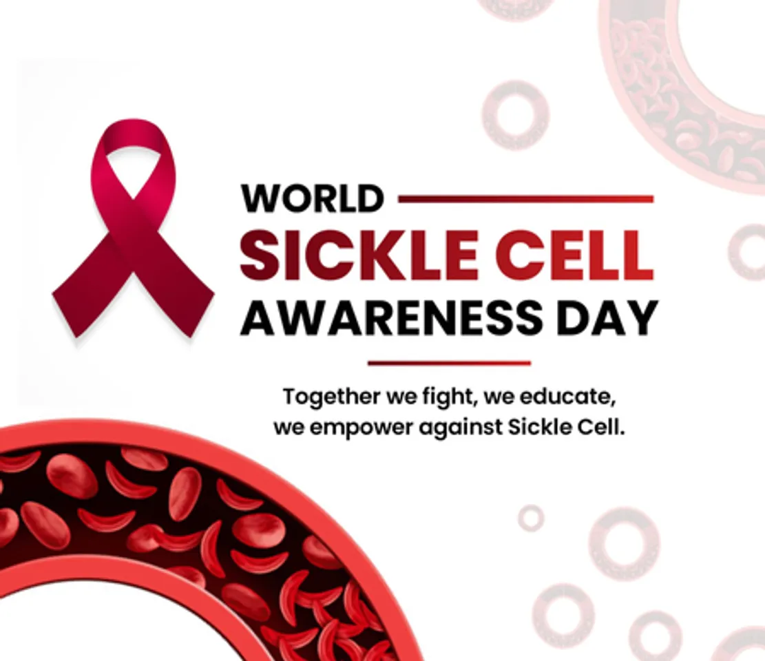 5.72 crore people screened for Sickle Cell Disease: Centre