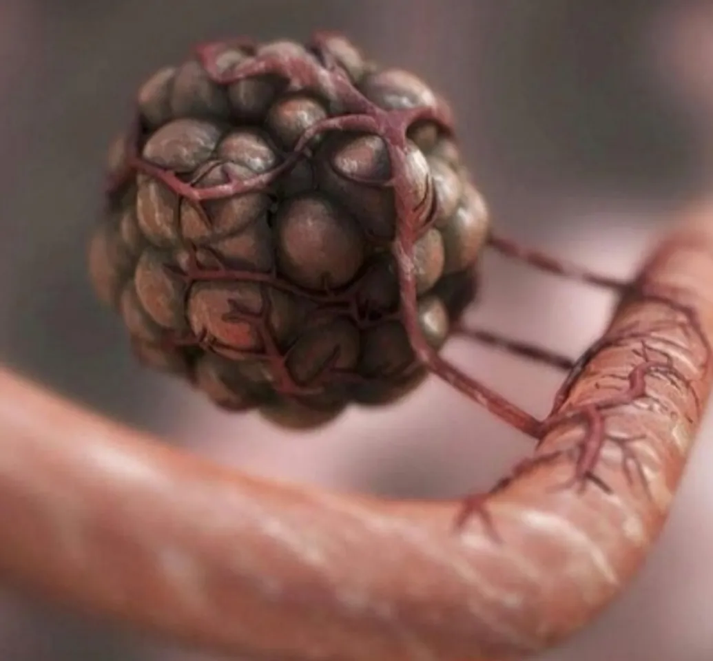 tumor cell,  blood supply,cancer