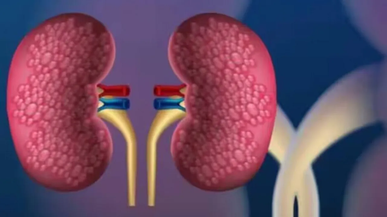 Kidney Representative Image 