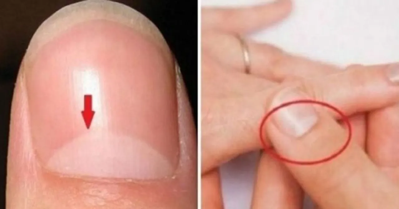 ଆପଣଙ୍କ ନଖରେ ଅର୍ଦ୍ଧଚାନ୍ଦ ଭଳି ଧଳା ଚିହ୍ନ ଅଛି କି? ଜାଣନ୍ତୁ ଏହା ପଛର ରହସ୍ୟ.....