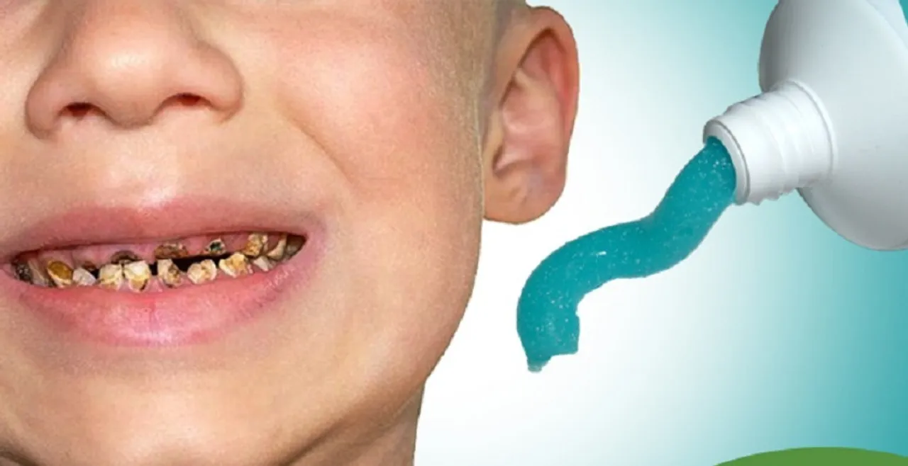 ପୋକରା ଦାନ୍ତରୁ ମୁକ୍ତି ଚାହୁଁଛନ୍ତି: ଘରେ ବନାନ୍ତୁ ଏହି ପେଷ୍ଟ