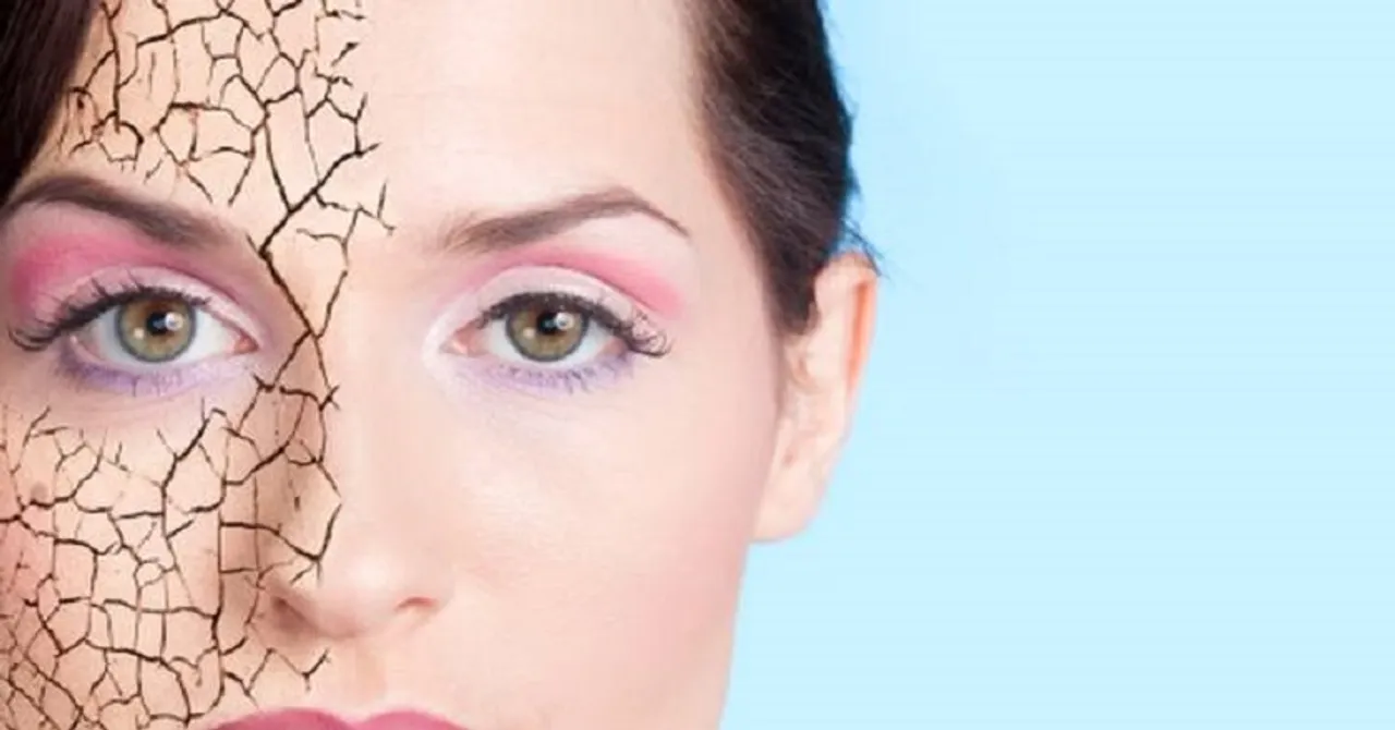 ଜାଣନ୍ତୁ ଡ୍ରାଏ ସ୍କିନ୍‌ର ଲକ୍ଷଣ ଓ ଉପଚାର