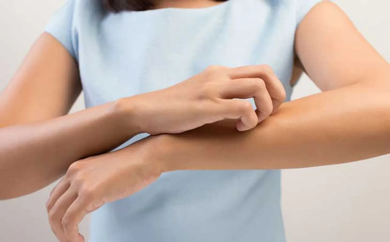 କିଛି ଚର୍ମ ରୋଗ ଅଛି କି? ପ୍ରତି ମଙ୍ଗଳବାର ଏହି କାମ କରନ୍ତୁ