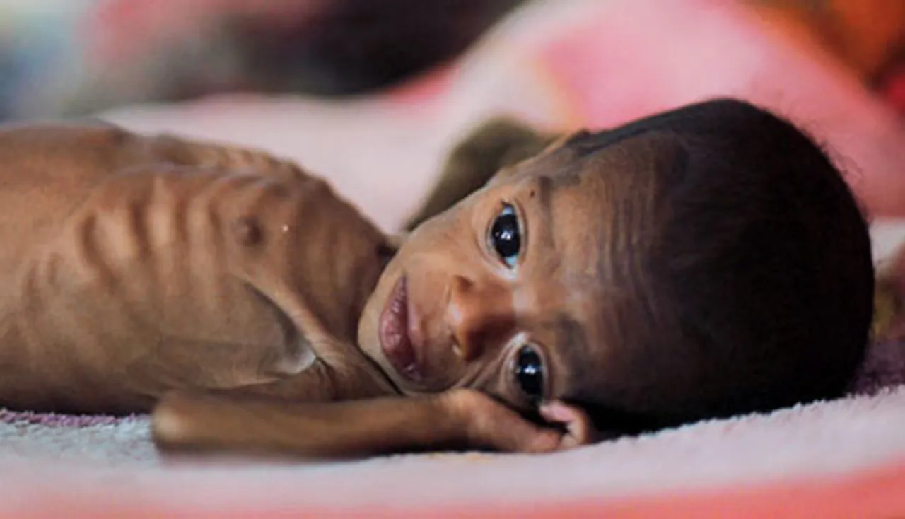 ଏପଟେ ପୁଷ୍ଟିକର ମାସ ପାଳନ, ସେପଟେ ୩ ଅନାହାର ମୃତ୍ୟୁ !