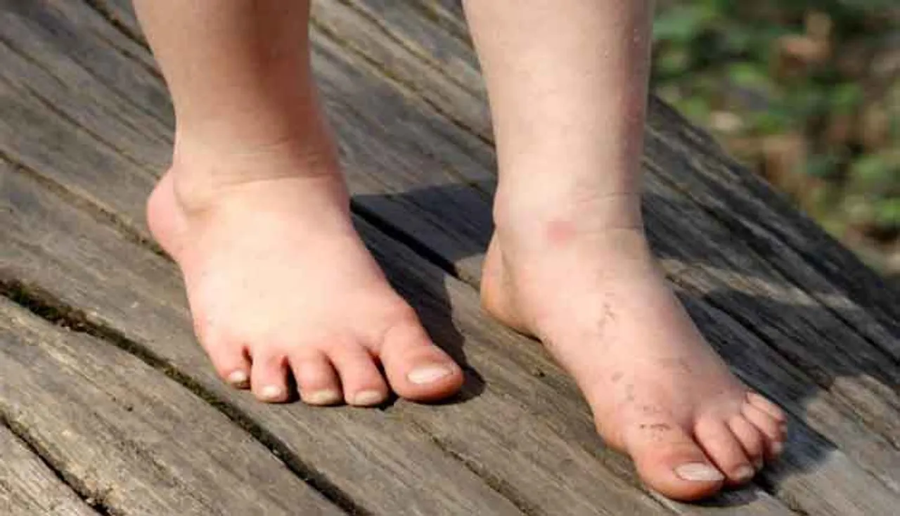 ଆପଣଙ୍କ ପିଲା ଖାଲି ପାଦରେ ଚାଲୁଛି କି...