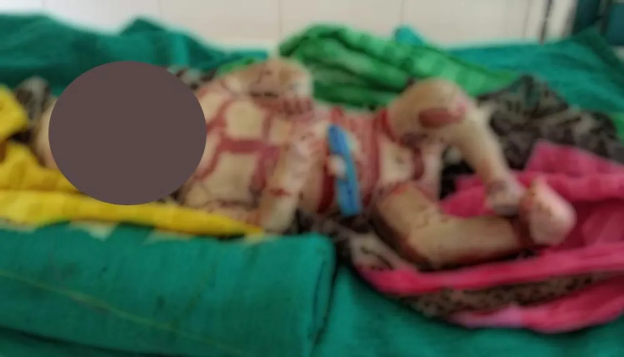 ଅନୁଗୋଳରେ ଅଦ୍ଭୁତ ଶିଶୁ ଜନ୍ମ