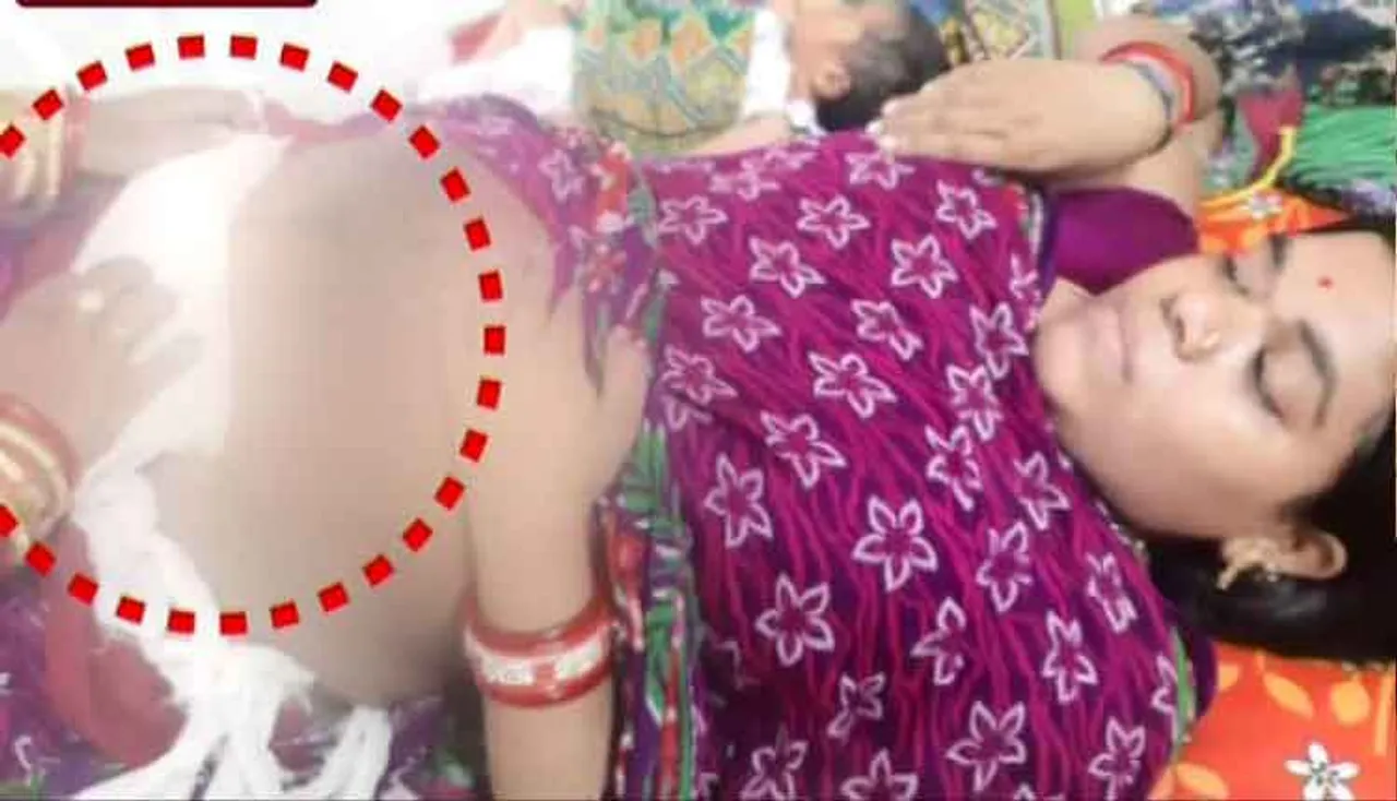 ଡାକ୍ତରଙ୍କ ଅବହେଳା ଯୋଗୁ ଖୋଲିଗଲା ପ୍ରସୂତିଙ୍କ ଷ୍ଟିଚ୍‌