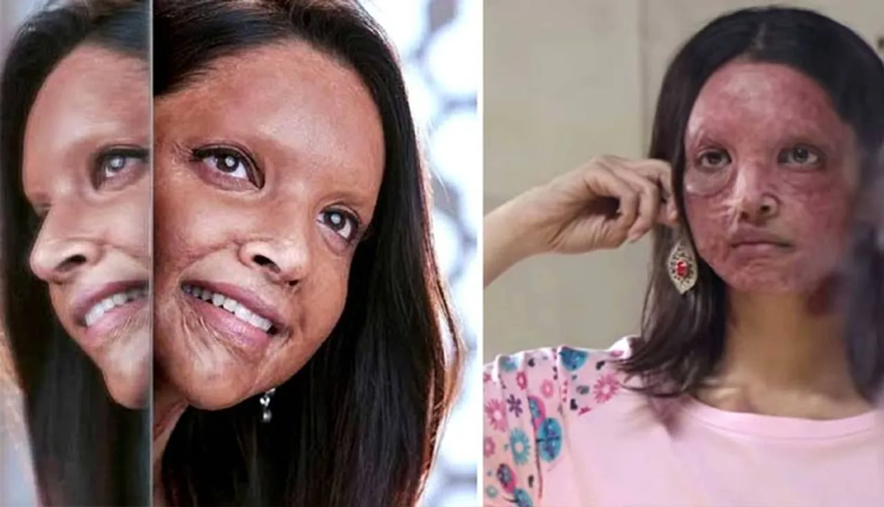 ପ୍ରଥମ ଦିନରେ ‘ଛପାକ’କୁ ମିଳିଛି ଆଶା ମୁତାବକ ଆୟ