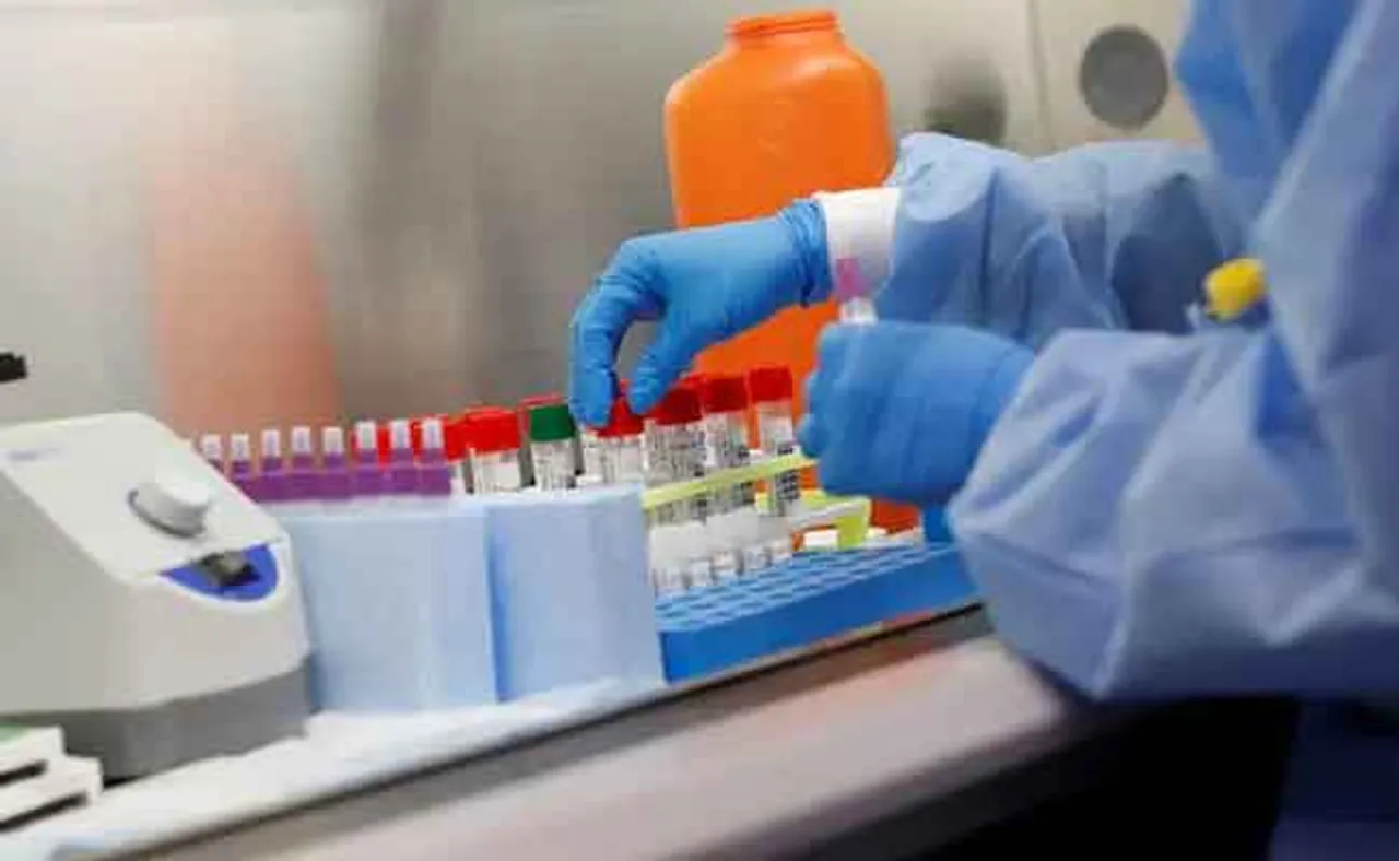 ଓଡ଼ିଶାରେ କରୋନା ପଜିଟିଭ୍‌ ହାର ୧.୪୭%, ଭେଣ୍ଟିଲେଟରରେ ୨ ରୋଗୀ