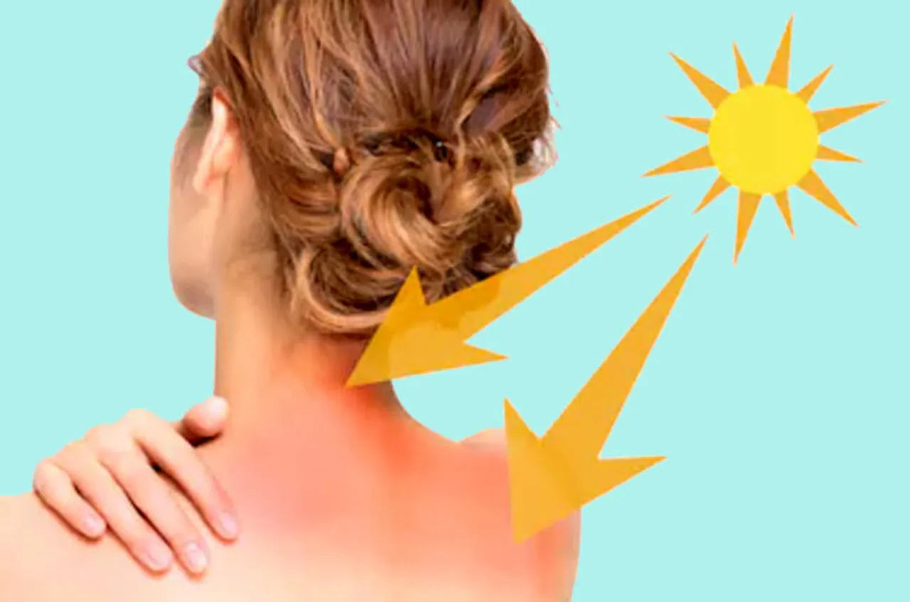 ସନ୍‌ବର୍ଣ୍ଣ କଷ୍ଟରୁ ମୁକ୍ତି ଦେବ ୫ଟି ଘରୋଇ ଉପଚାର