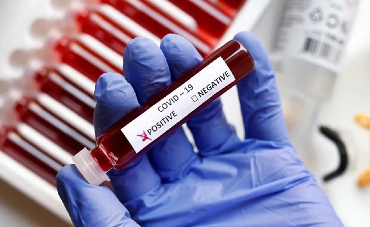 ରେଳ ମନ୍ତ୍ରାଳୟର ଆଉ ୨ ଅଧିକାରୀ କରୋନାରେ ଆକ୍ରାନ୍ତ