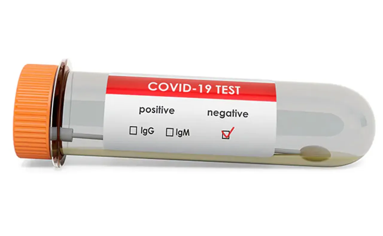 ରାଜ୍ୟରେ ସୁସ୍ଥ ହେଲେ ଆଉ ୪୦୮ କରୋନା ଆକ୍ରାନ୍ତ