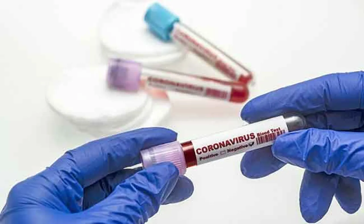 ୧୧ ଜିଲ୍ଲାରୁ କରୋନା ନେଲା ୨୧ ଜୀବନ, କେବଳ ୨ଟି ଜିଲ୍ଲାରୁ ୭ ଜଣଙ୍କ ମୃତ୍ୟୁ