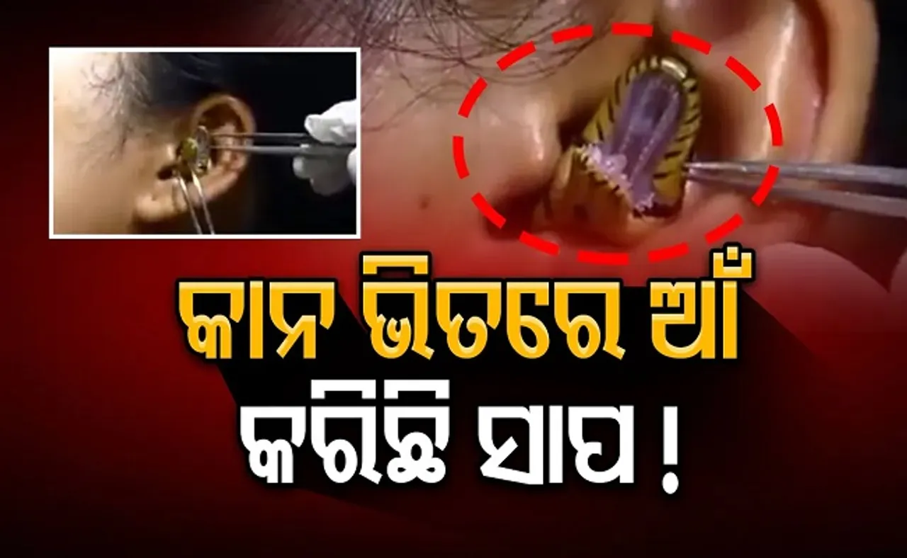 କାନ ଭିତରେ ଆଁ କରିଛି ସାପ!