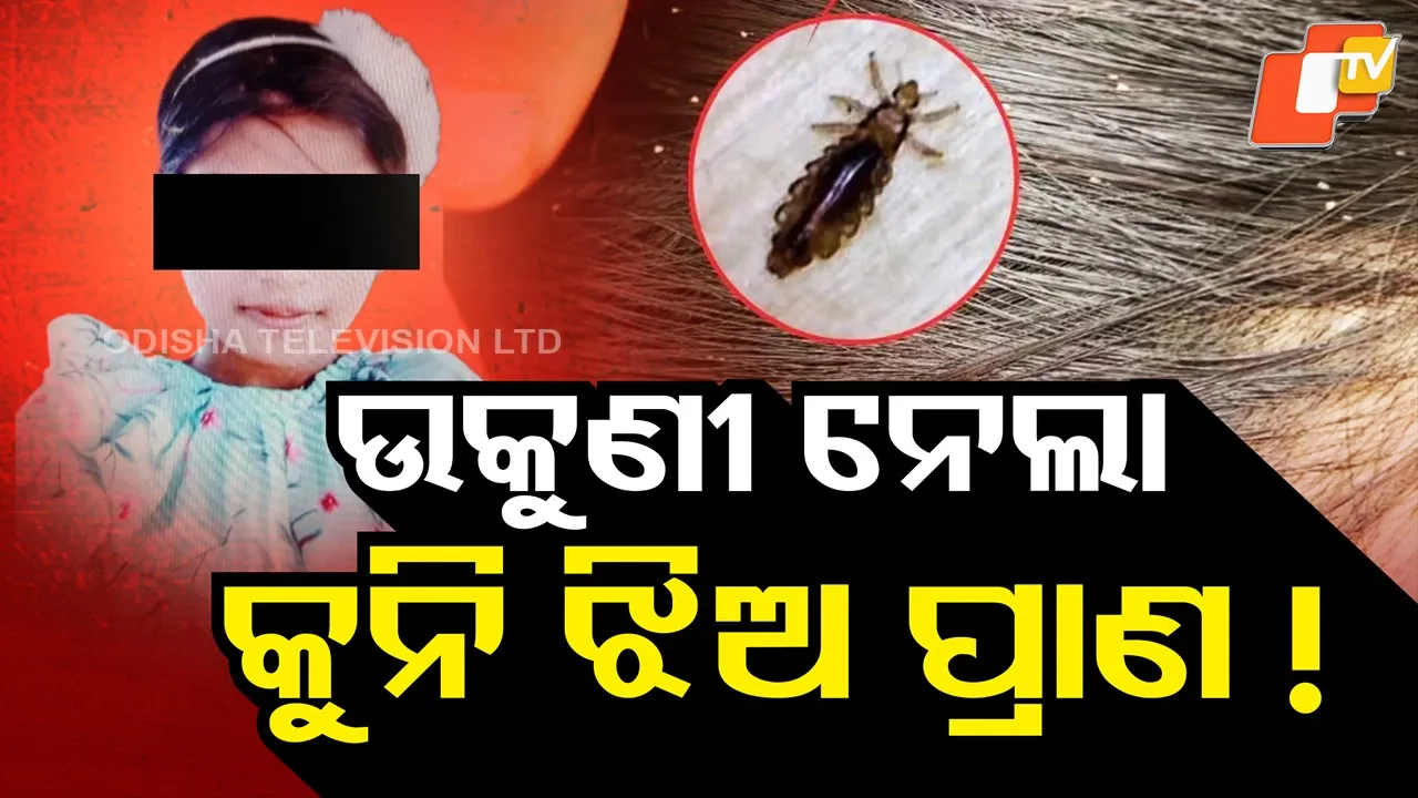 Severe Lice Infection