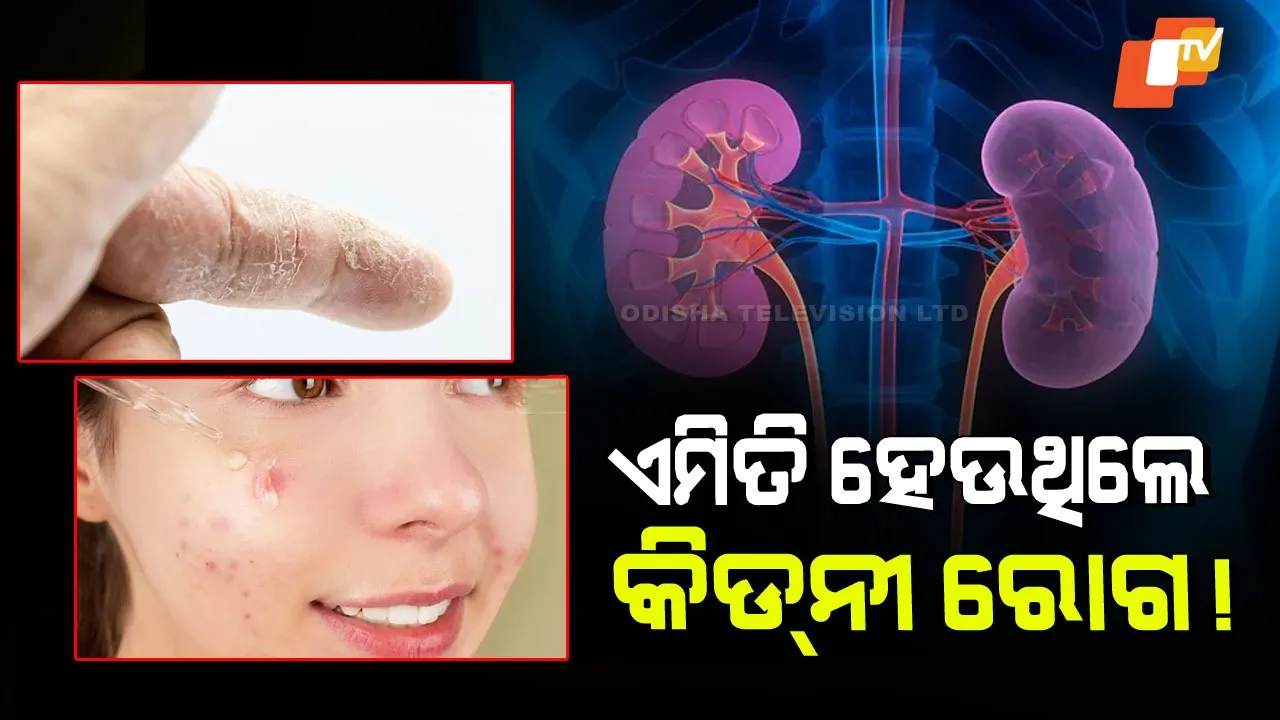 Early Signs of Kidney Disease