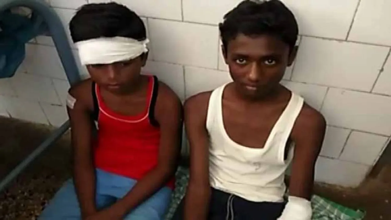 ବାଇକ୍ ଧକ୍କାରେ ସ୍କୁଲ୍‌ ଛାତ୍ରଛାତ୍ରୀ ଗୁରୁତର