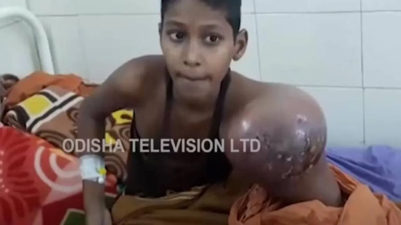 ଯନ୍ତ୍ରଣାରେ ଜର୍ଜରିତ ଅଭୟ