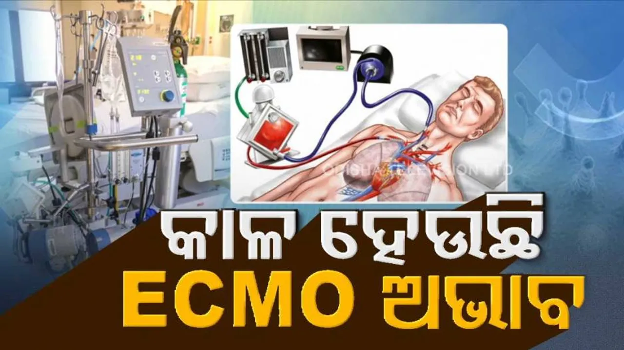କାଳ ହେଉଛି ECMO ଅଭାବ: ଚିକିତ୍ସା ପାଇଁ ବାହାର ରାଜ୍ୟକୁ ଯାଉଛନ୍ତି ଗୁରୁତର ରୋଗୀ