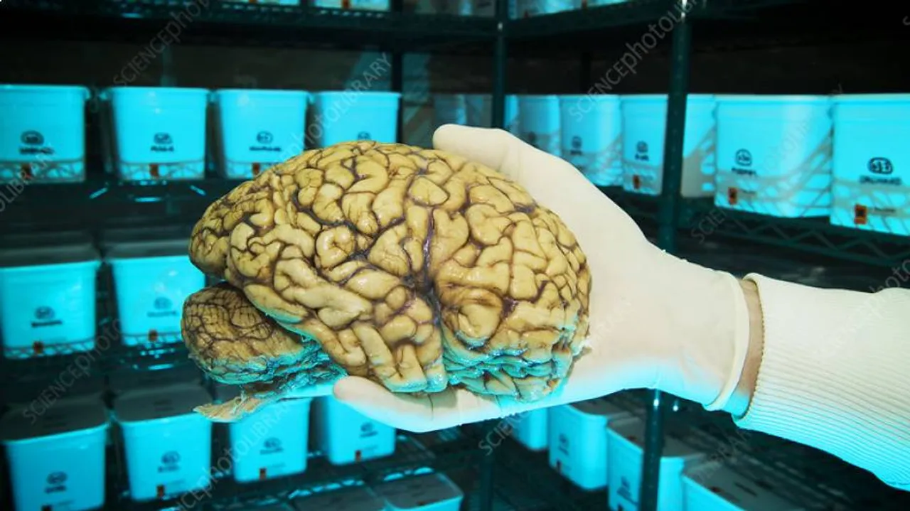 Brain bank