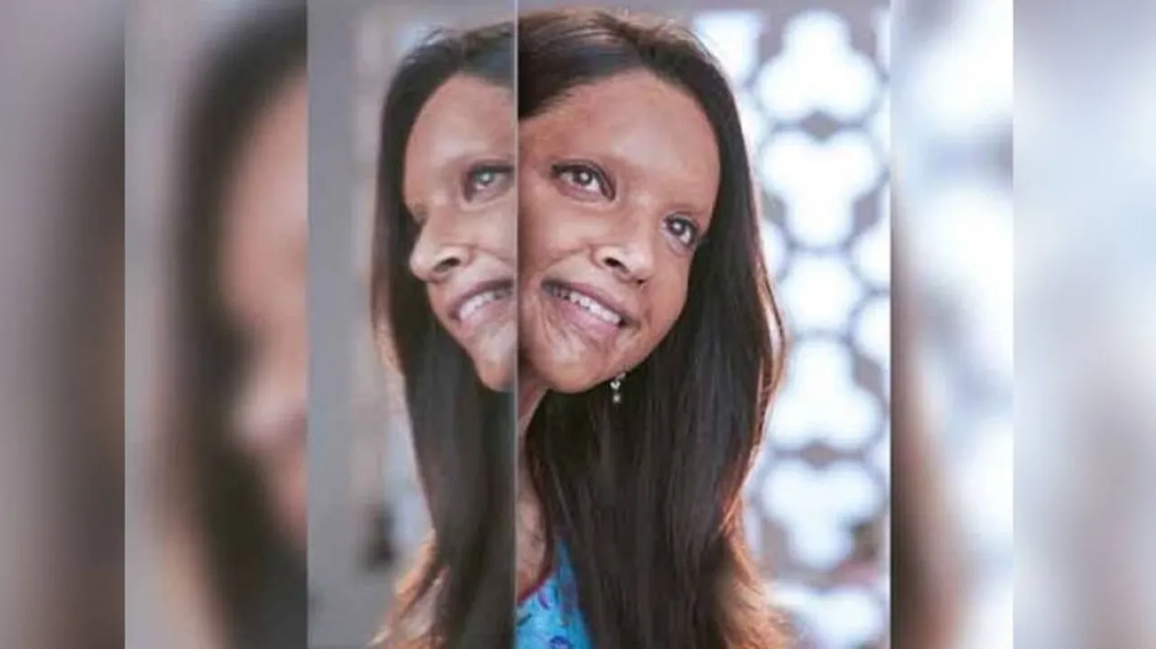 ବହୁ ପ୍ରତୀକ୍ଷିତ ଫିଲ୍ମ ‘ଛପାକ୍‌’ର ଟ୍ରେଲର ରିଲିଜ