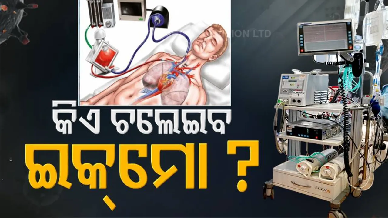 ECMO ମେସିନ୍‌ ଲାଗିଲା ପରେ ତାକୁ ଚଳାଇବାକୁ ଲୋକ ଅଛନ୍ତି ତ?