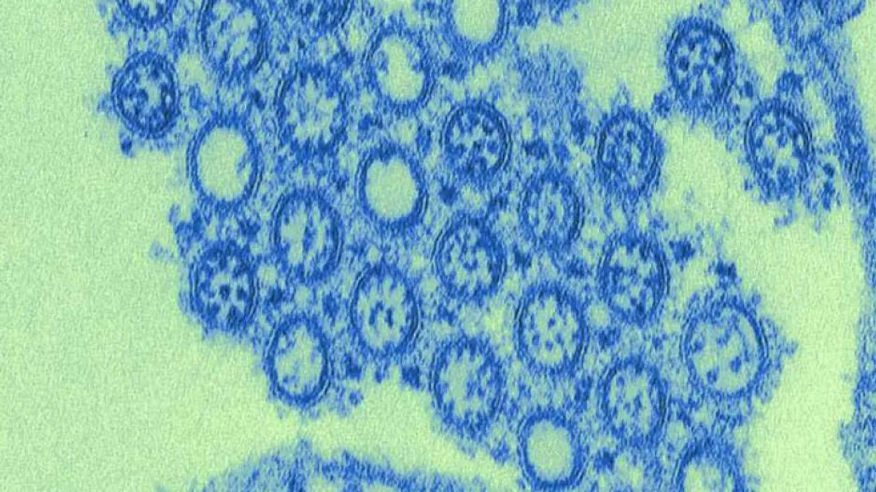 ମୁମ୍ବାଇ ସାମ୍ନାରେ ନୂଆ ସଙ୍କଟ : କରୋନାରୁ ଠିକ ହେବା ପରେ ସ୍ୱାଇନ୍ ଫ୍ଲୁରେ ପୀଡ଼ିତ ହେଉଛନ୍ତି ରୋଗୀ