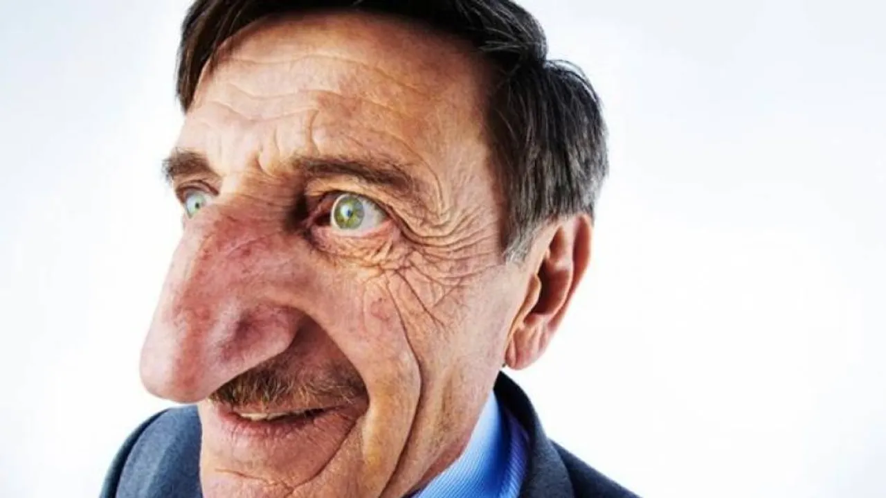 Worlds biggest nose