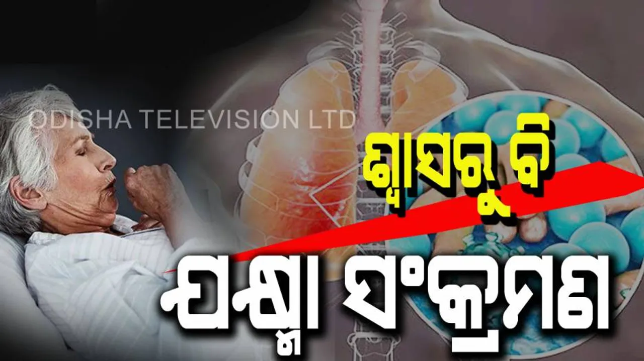 TB is caused by the breath of infected person