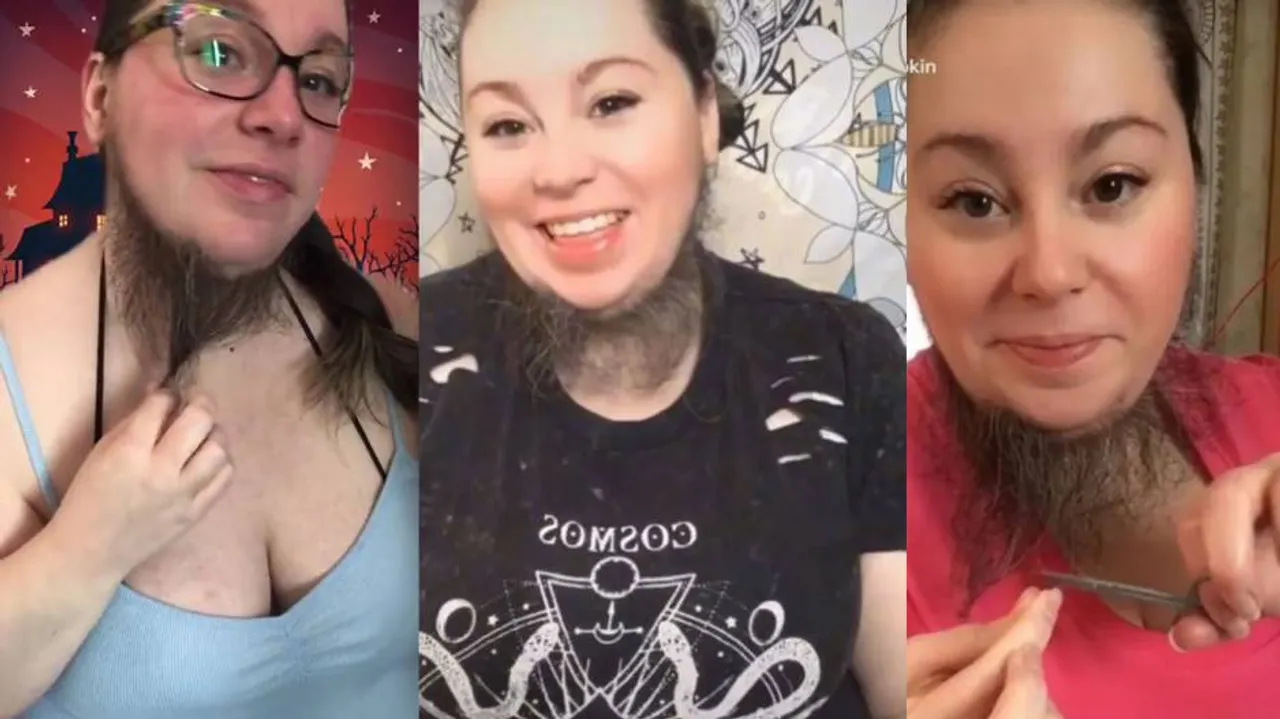 Bearded woman inundated by male