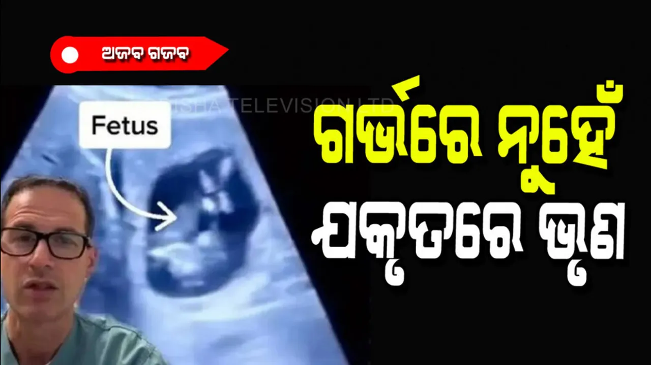 Woman found pregnant with baby in liver