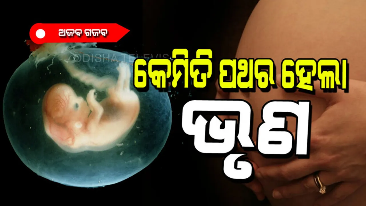 A baby stone about 2 kg was found in stomach