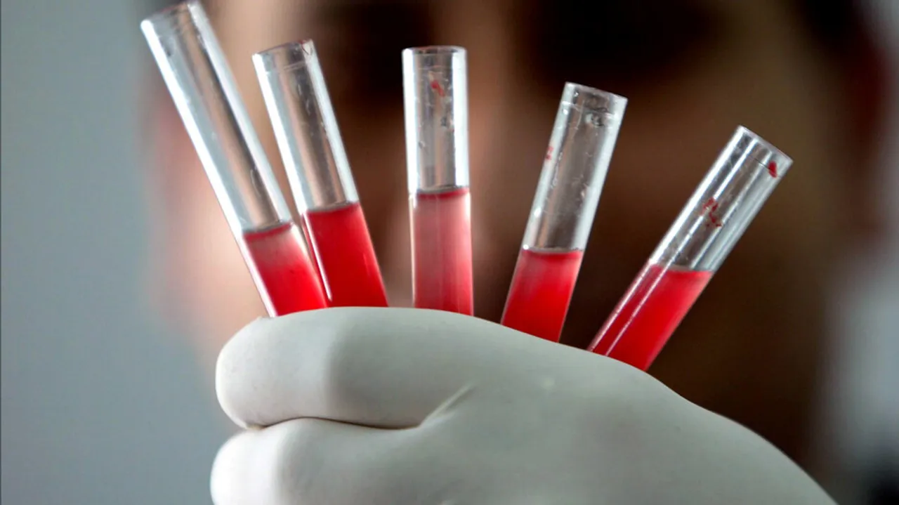 The Golden Blood is found in only 43 people