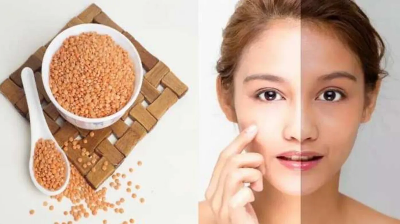 lentil pulses for skin