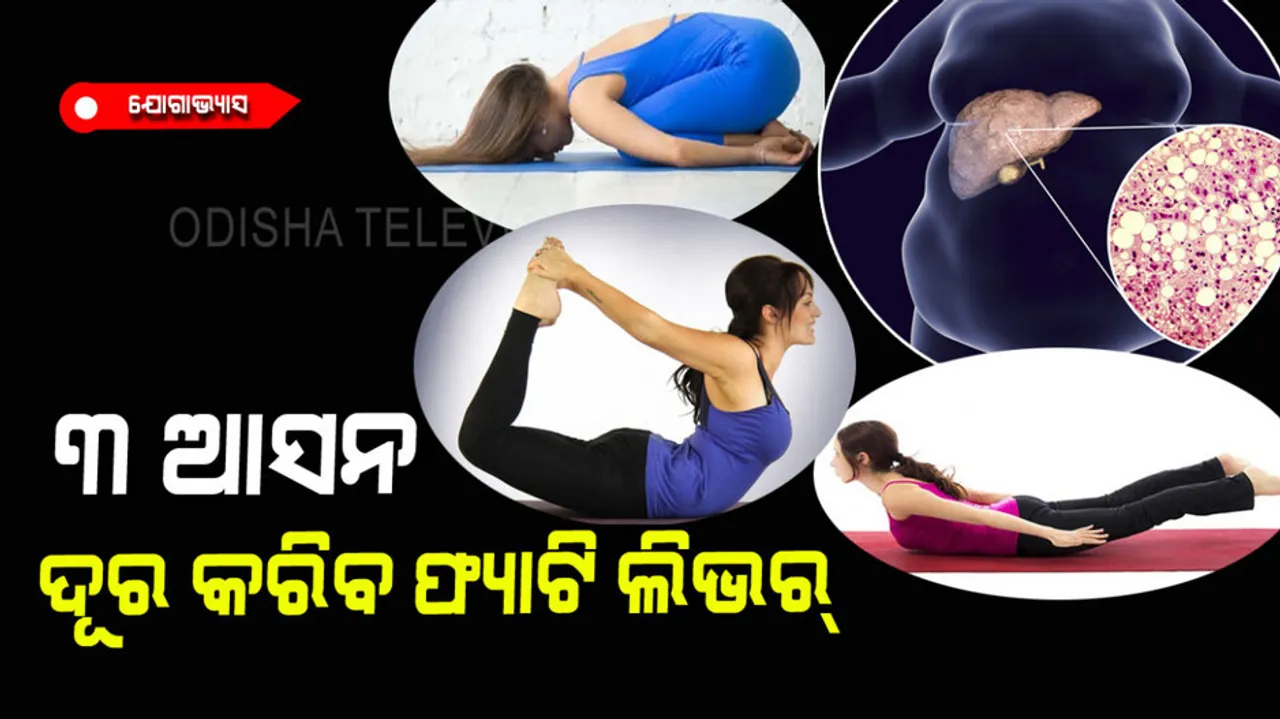 Yoga for fatty liver disease