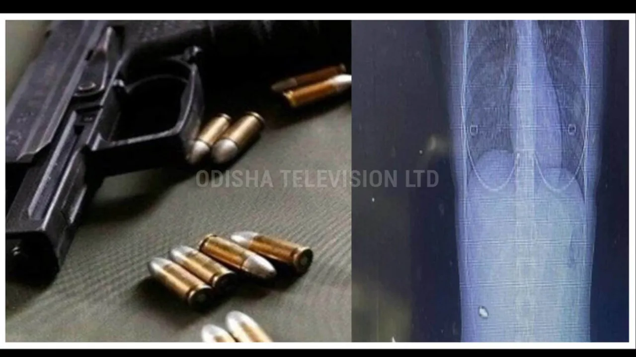 Strange woman living with bullet in back for 15 years know detail