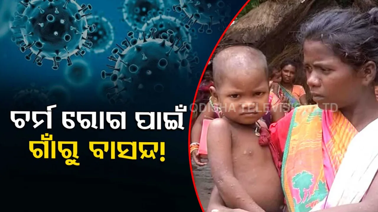 discrimination for Skin Diseases