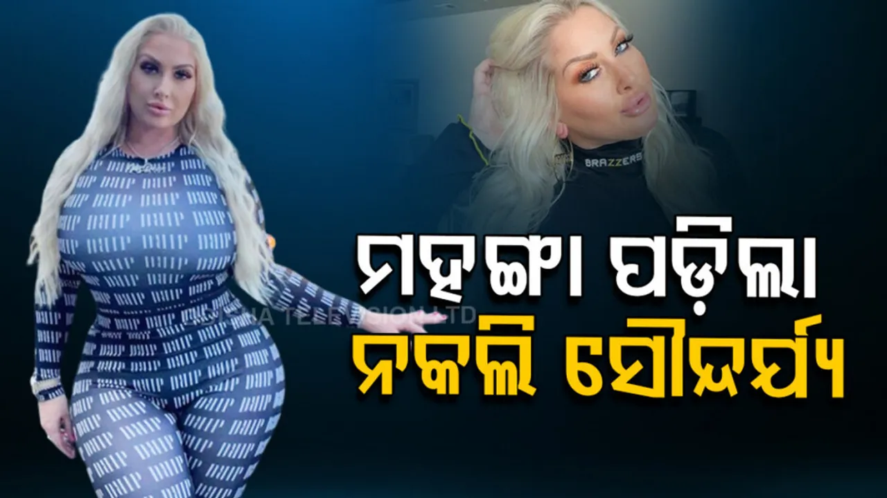 Woman Spent 40 Lakh On Plastic Surgery